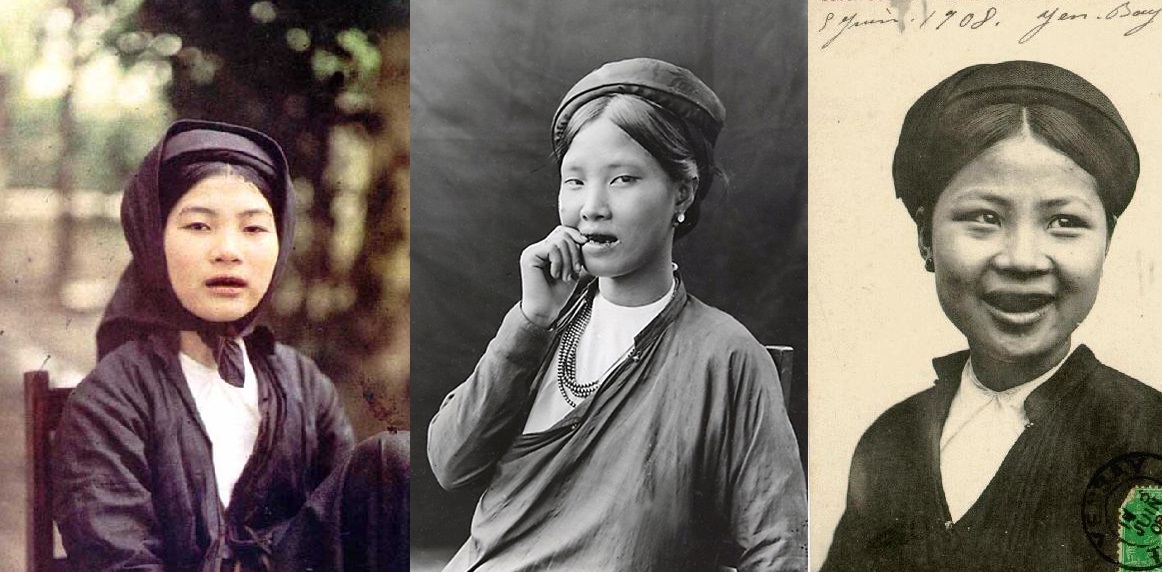 Black teeth Vietnam's once hot beauty regimen